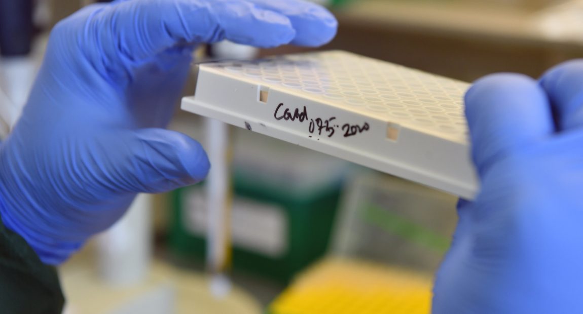 SKANDAL: Razotkriveni testovi na koronu! Pogledajte što su otkrili, kako da im uopće više vjerujemo?!