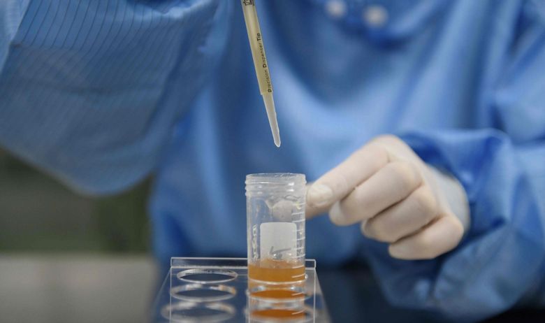 STIGLI PRVI REZULTATI SEROLOŠKIH TESTOVA U AMERICI Znanstvenici vjeruju da je koronavirus daleko rašireniji među populacijom nego što se mislilo