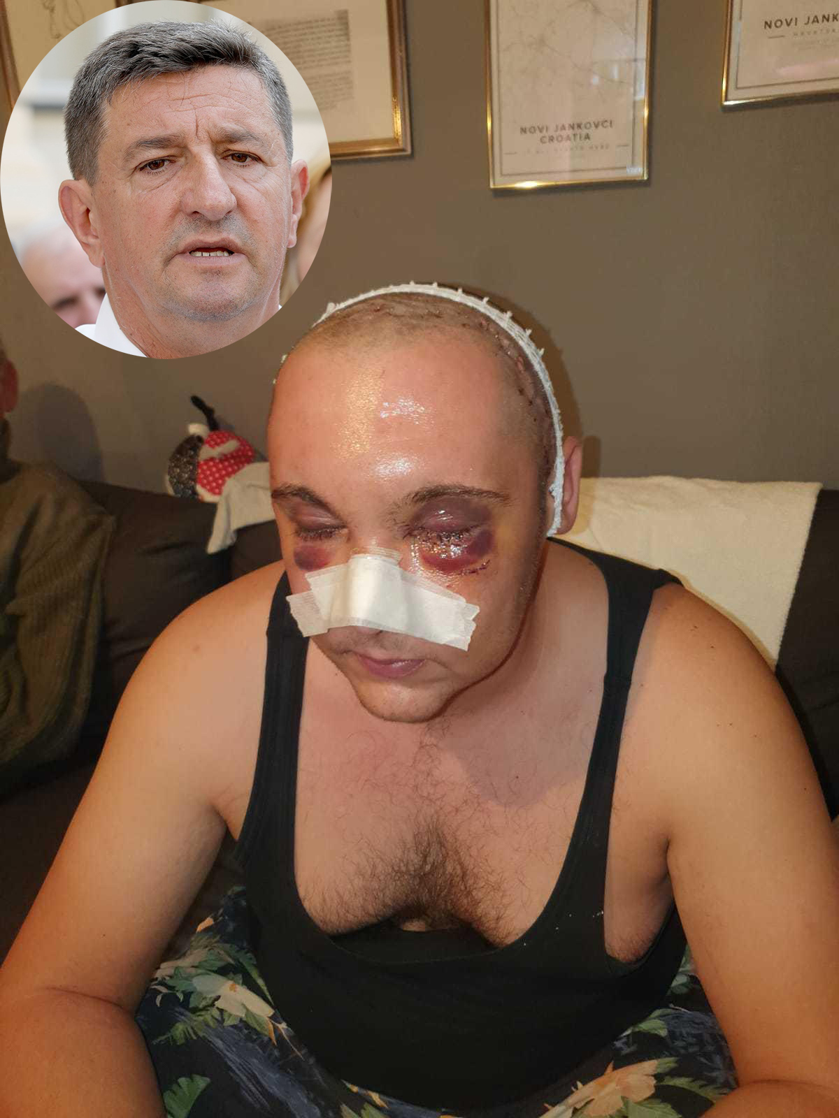 Željko Sačić traži HITNO očitovanje ministra Božinovića vezano za vinkovački slučaj premlaćivanja mladića hrvatske nacionalnosti Ivana Andrijanića od strane mladića srpske nacionalnosti iz Srijemskih Laza