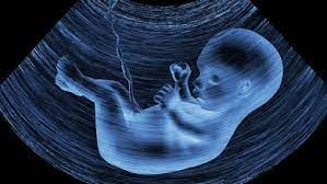 Zabrana ubijanja čovjeka bilo koje dobi?