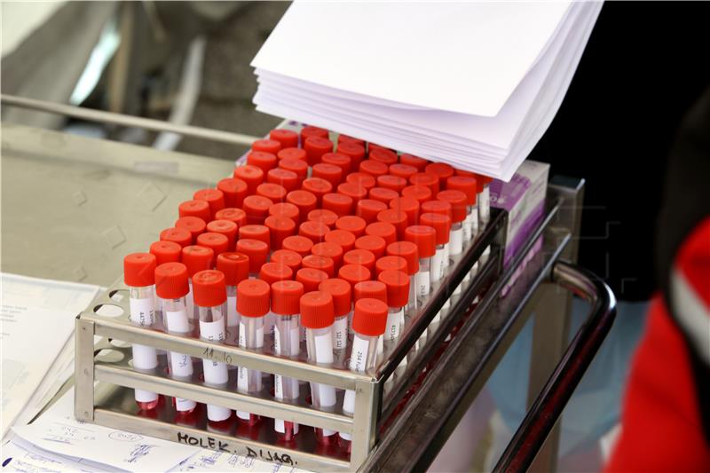 U Hrvatskoj nova 373 slučaja zaraze koronavirusom, umrle tri osobe