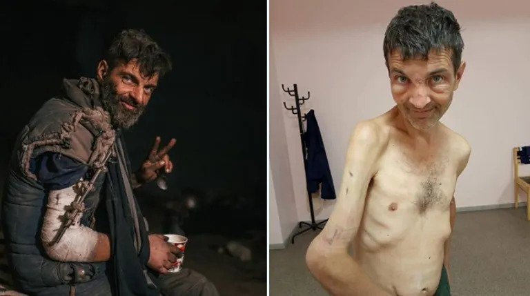 Borac iz Azovstala u četiri mjeseca robije u ruskom zatvoru izgubio 40 kilograma