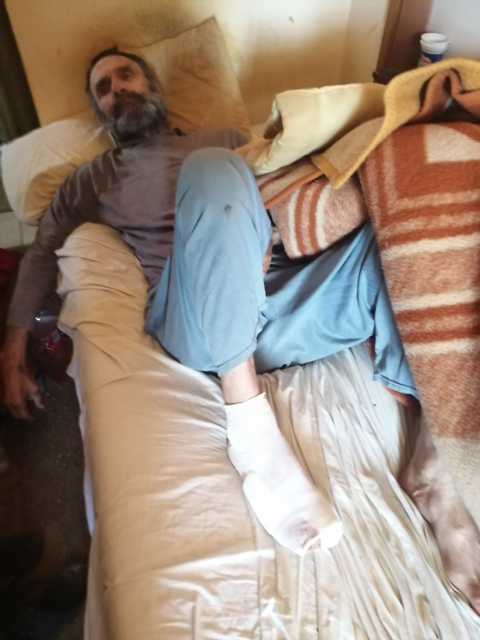 NIKICA LUŠA – leži u bolovima kod kuće, prijeti mu amputacija noge, a adekvatne pomoći nema