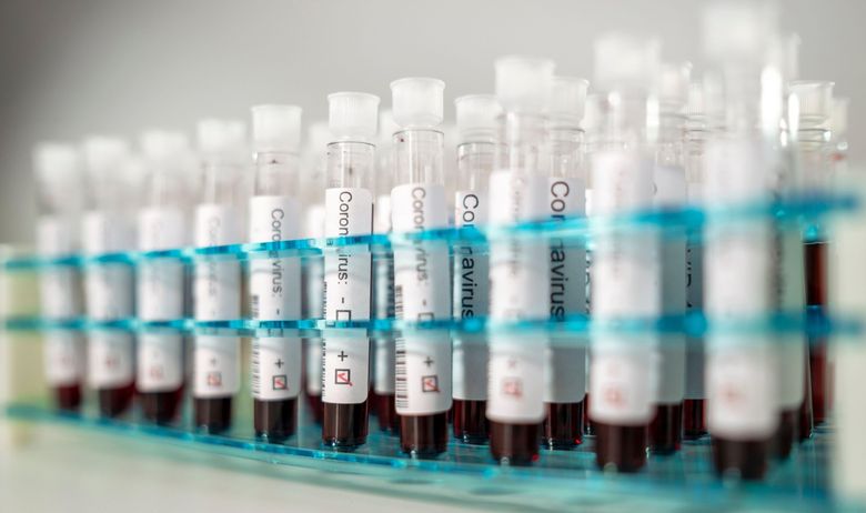 SARAH GILBERT:   'Imat ćemo cjepivo protiv korone već u rujnu, 80 posto sam sigurna"