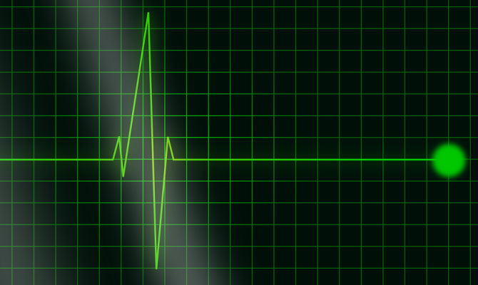 Radar otkriva prijeti li vam moždani ili srčani udar, a može i predvidjeti smrt – 4 dana ranije
