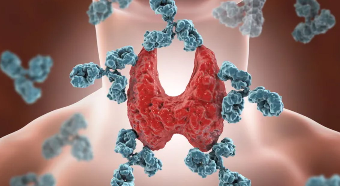 Covid može potaknuti stvaranje loših antitijela, mogli biste završiti s problemima do kraja života?