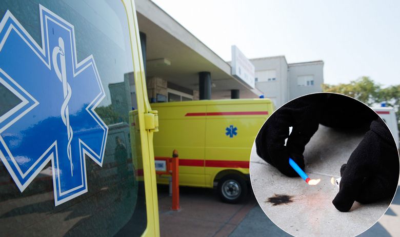 MUŠKARAC KOD TRILJA TEŠKO OZLIJEĐEN U EKSPLOZIJI PETARDE Ima opekotine i rasjekotine na licu, rukama i ramenu, operiran je u splitskoj bolnici