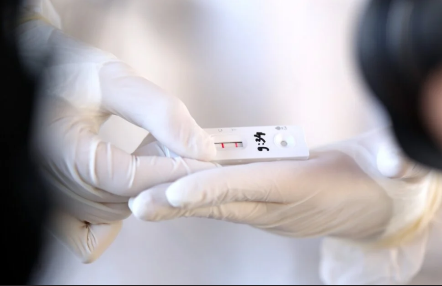 HZZO OBJAVIO Evo koliko će koštati brzi antigenski test na uputnicu