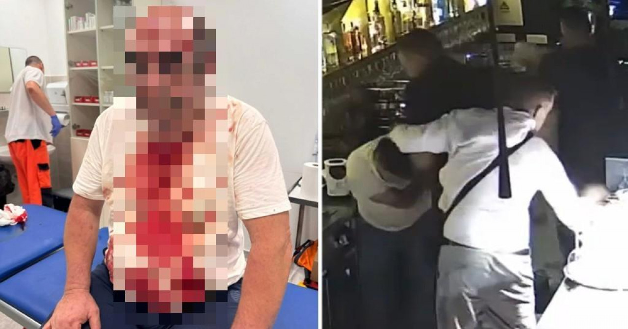 Brutalno pretučeni vlasnik poznatog hvarskog restorana i njegov kuhar: Korištene i šipke, gradom kruži priča o okidaču bezumnog čina