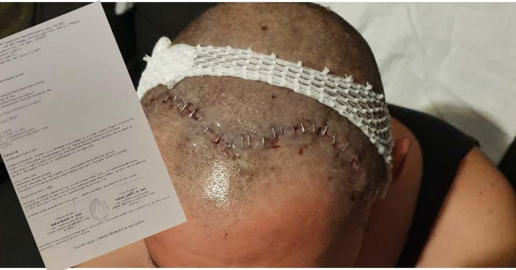 Slavili rođenje djeteta, a na kraju pretukli gosta zbog ‘krive glazbene želje‘: ‘Doslovno su mi skakali po glavi‘ (Foto: stravično)