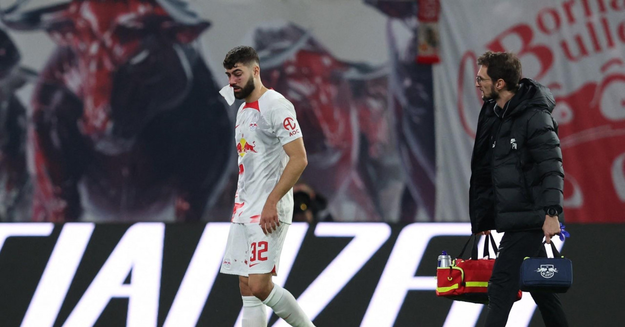 OZLIJEDIO SE GVARDIOL Trener Rose: “Čuo sam od Joška da ima slomljen nos"