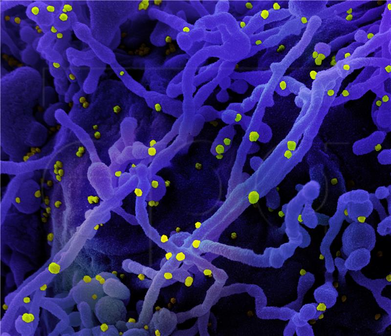 Istra bez novozaraženih, umro Talijan