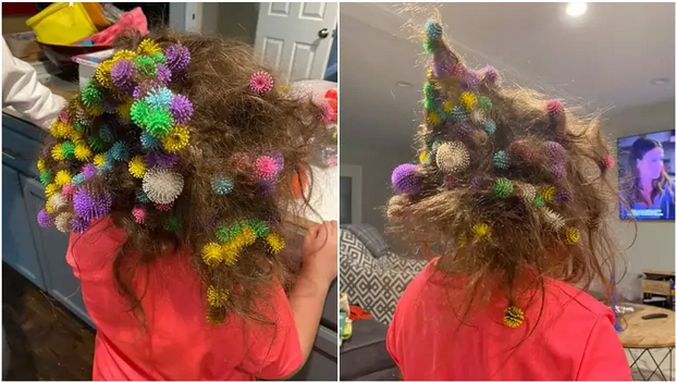 BILO IH JE OKO 150 Za sjest i plakat: Mama je kćeri 20 sati vadila igračke iz kose