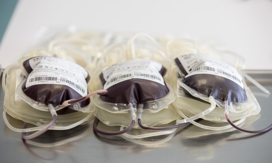 Kritično stanje u splitskom KBC-u: Velika nestašica krvi, operacije bi se mogle odgađati