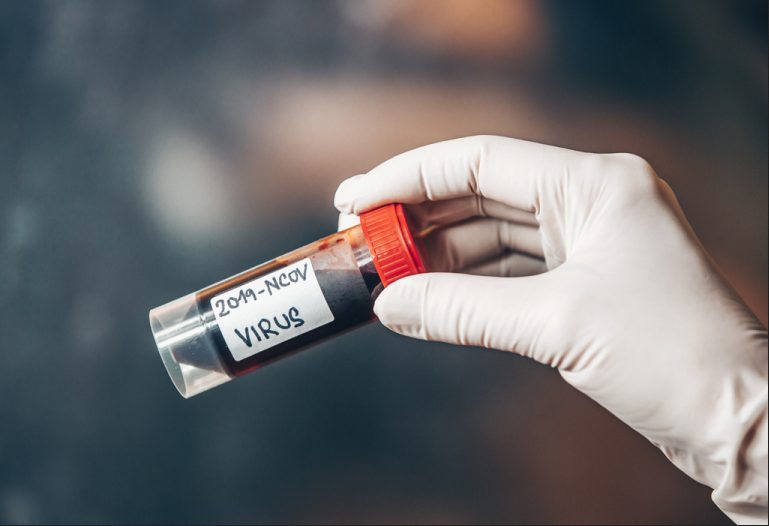 IMAMO SJAJNE VIJESTI: Svih šest uzoraka testiranih na koronavirus je NEGATIVNO