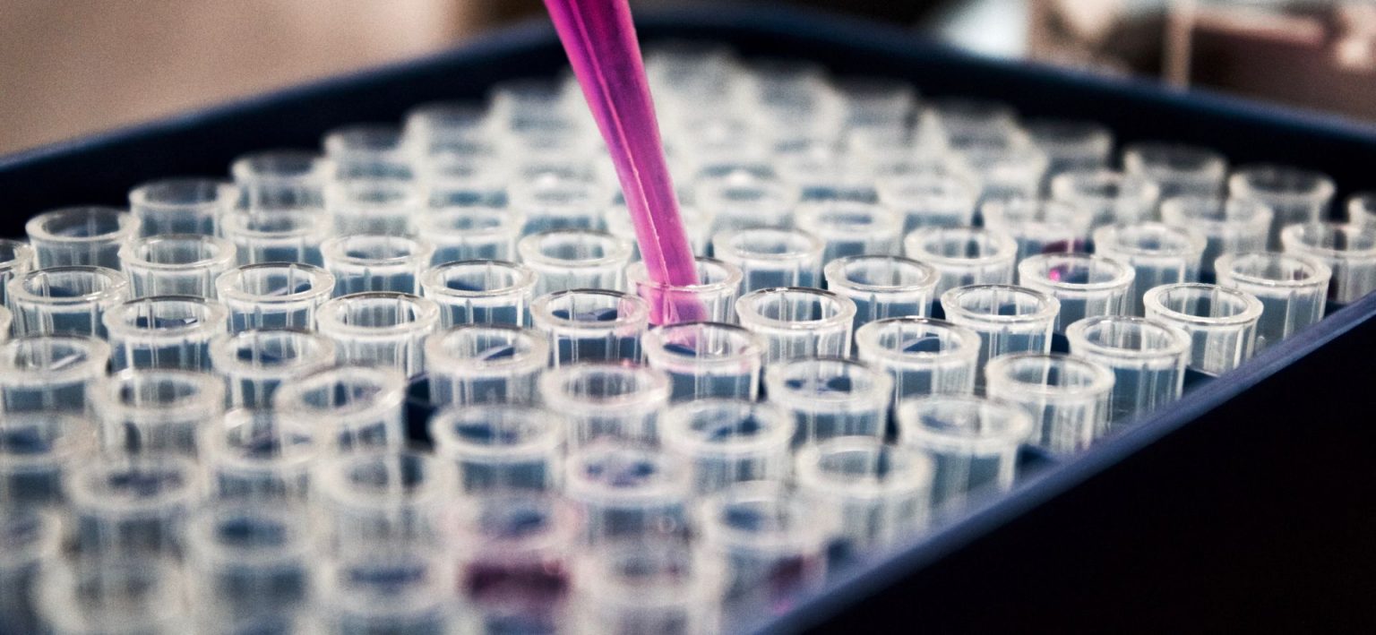 Započelo je testiranje nacije, uskoro ćemo znati koliko je građana bilo zaraženo