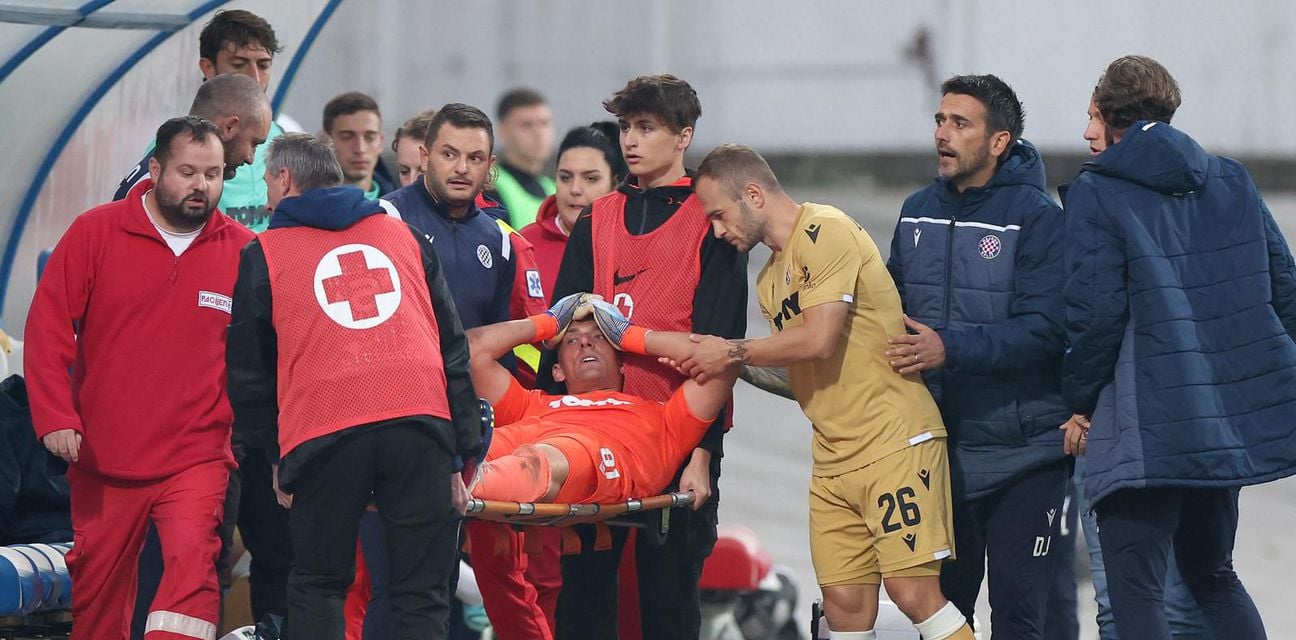 Trenutak užasa koštao ga Svjetskog prvenstva: Kalinić zbog ozljede koljena propušta Katar