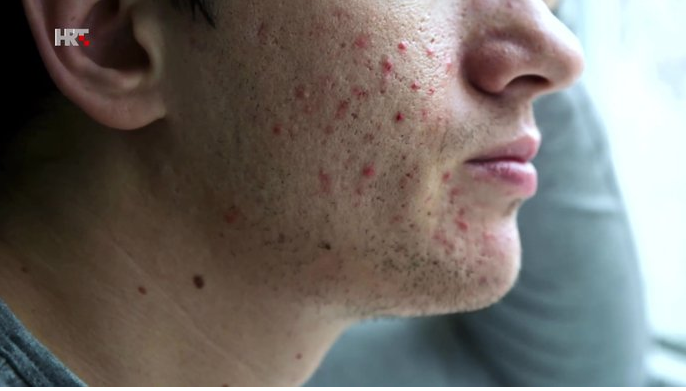 Zbog zaštitnih maski sve je više - maskni