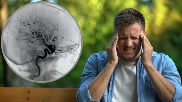 Moždani udar: Drugi je najčešći uzrok smrti, naučite prepoznati simptome