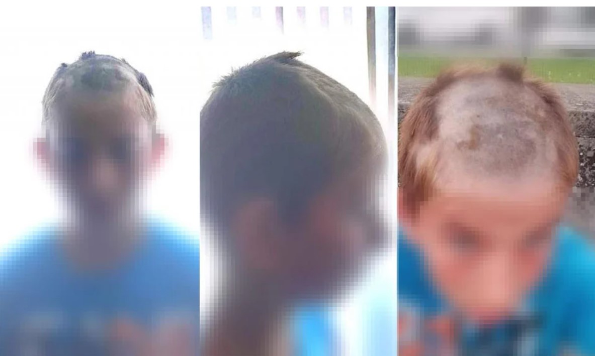 PRESTRAŠNO Na tržnici napadnut dječak, dvojica ga držala, a treći mu obrijao glavu