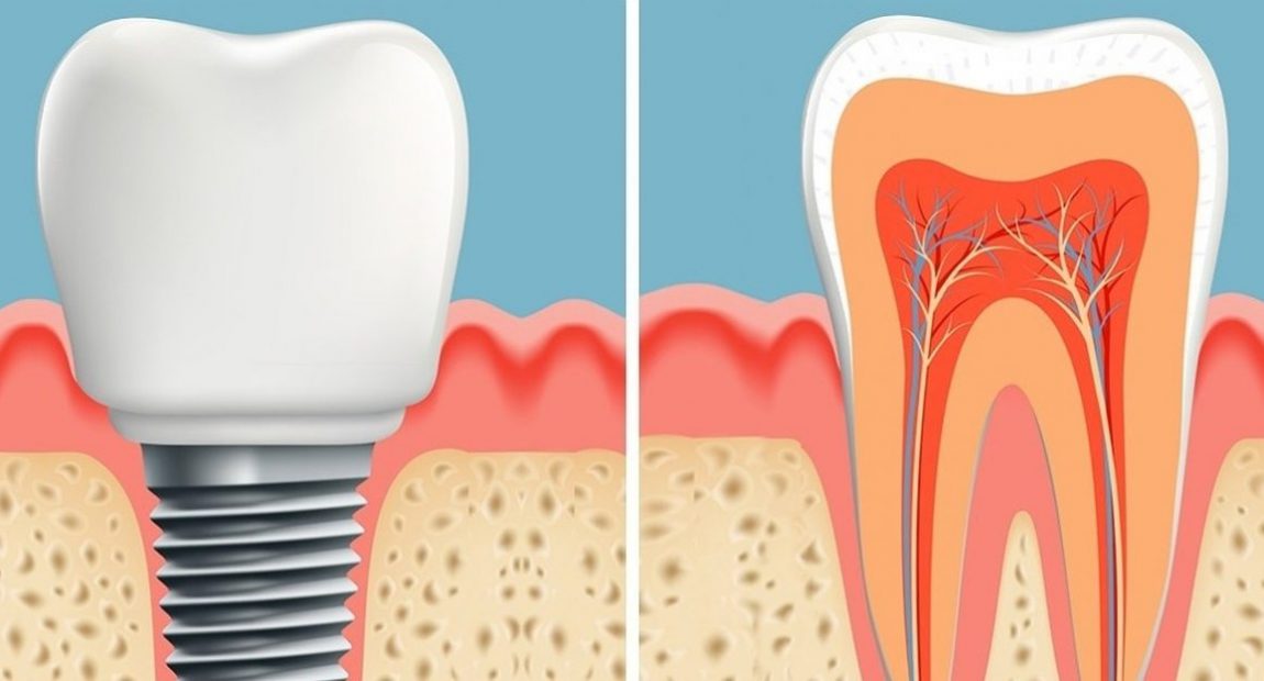 Znanstvenici pronašli način za ponovni rast zuba u samo 2 mjeseca
