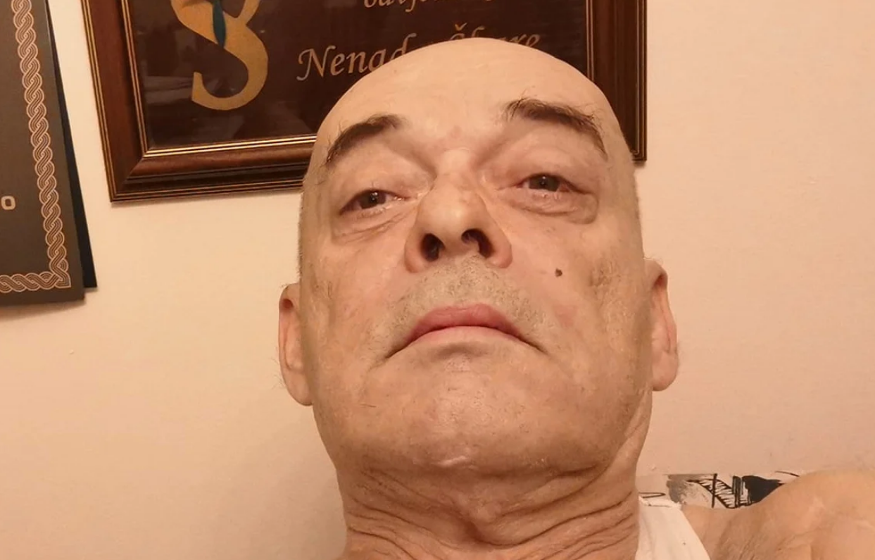 VALDEC VRAĆEN U BOLNICU! CT POKAZAO UGRUŠAK NA MOZGU! Stižu mu tisuće poruka iz cijelog svijeta