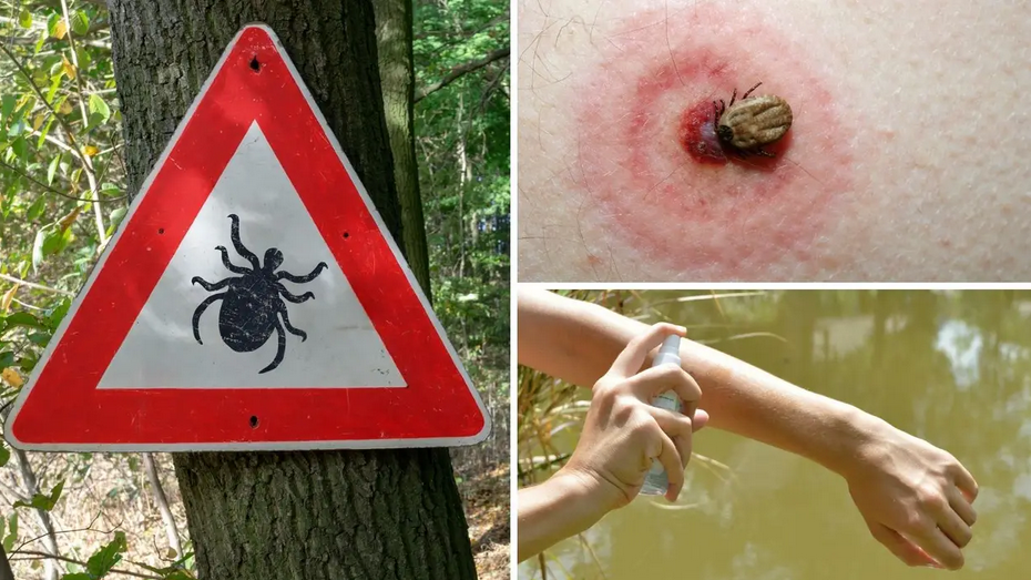 Savjeti liječnika: Krpelja nikad ne mažite uljem ili kremom